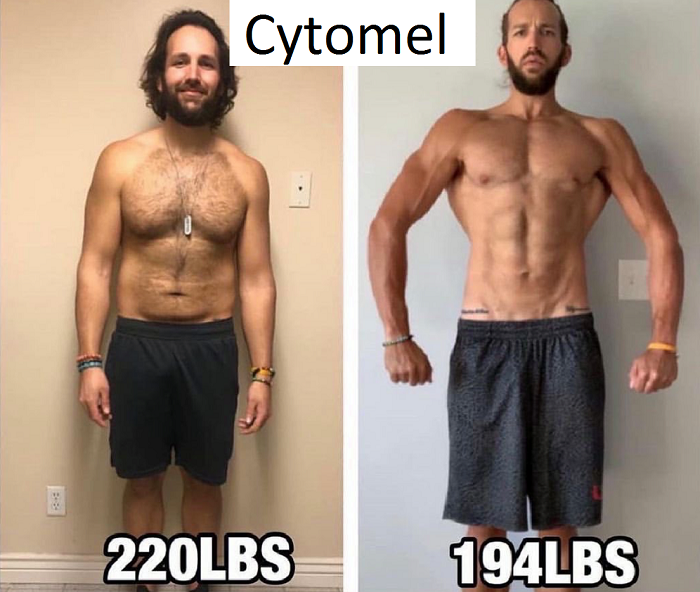 Cytomel-Weight-Loss-before-after